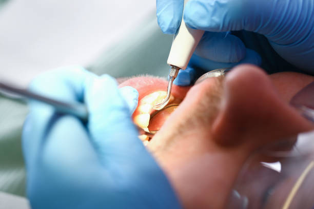 Best Emergency Gum Pain Relief  in Lifornia City, CA
