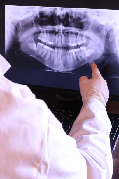 Emergency Gum Pain Relief in CA